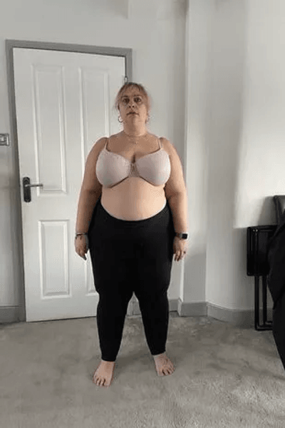 Жінка сильно скинула вагу, дієта, схуднення, як скинути вагу, здорове харчування, відмовилася від закуски, повна жінка