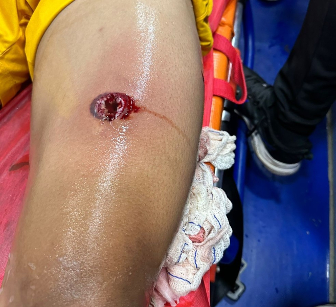 Матч регіональної ліги в Бразилії Матч регіональної ліги в Бразилії