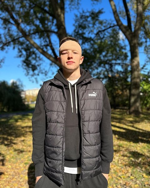 Анатолій Трубін травма