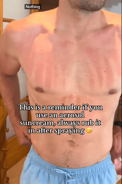 Мужчина нанес солнцезащитный крем, совершил большую ошибку