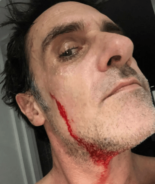 Ник порезался после первых движений бритвой во время бритья