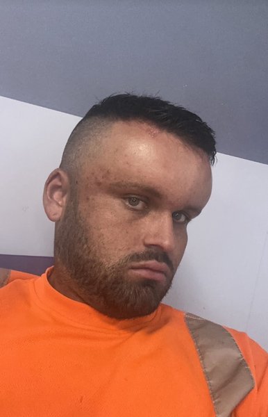 Курйоз в Британії, Ryan Briggs, Раян Брігс, лікування, алергія, набряк голови