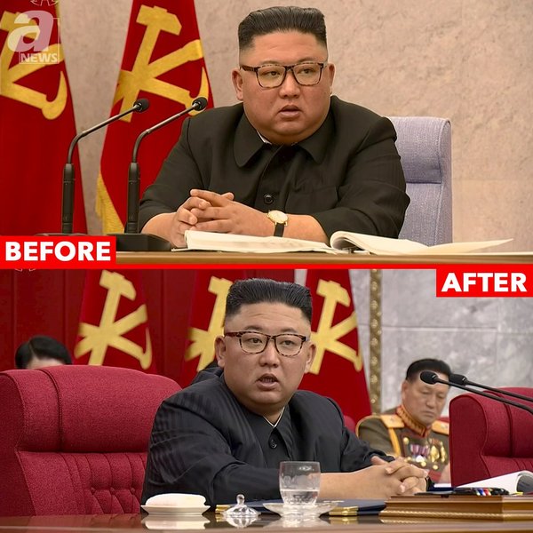 похудевший ким чен ын, похудение