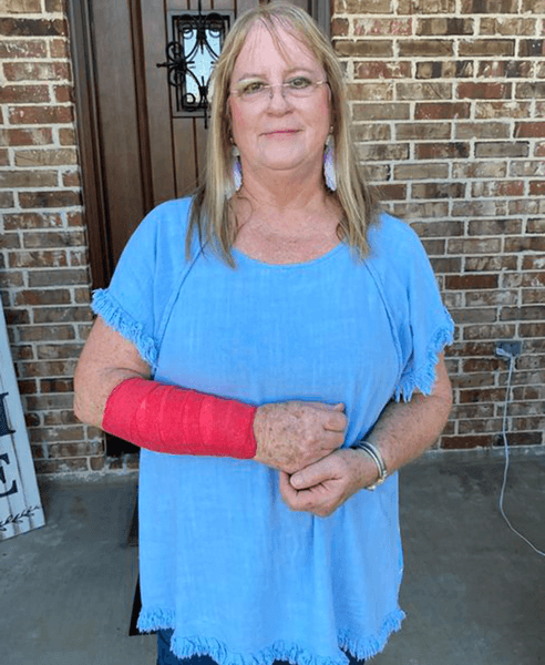 На женщину напали ястреб и змея, ястреб, змея упала с неба, повредил руку, доставили в больницу, яд змеи