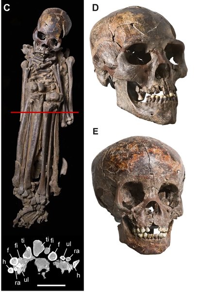 цукру скелет