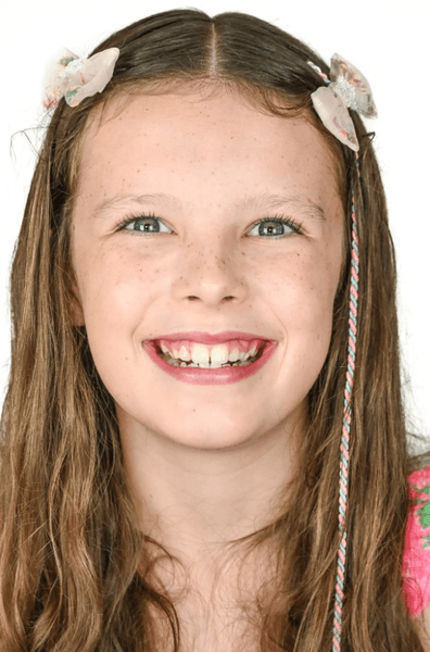 Ливана ела только наггетсы