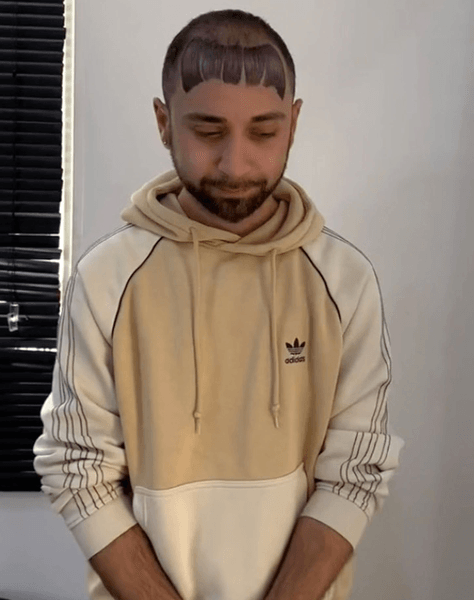 Татуювання на лобі, тату, татуювання волосся, тату чубчика на лобі, вірусний ролик, малюнок на голову, чоловік, що лисіє, лисина, випадіння волосся