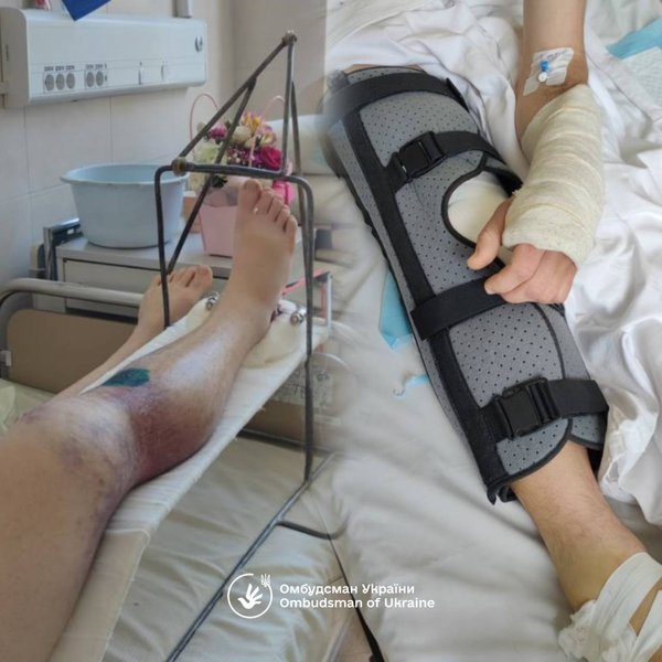 В Івано-Франківську поліція побила військовозобов’язаного