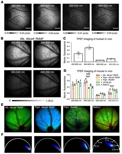 Лазер, сітківка, дослідження, хвороби, молекула