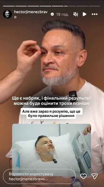 Ектор Хіменес-Браво после операции