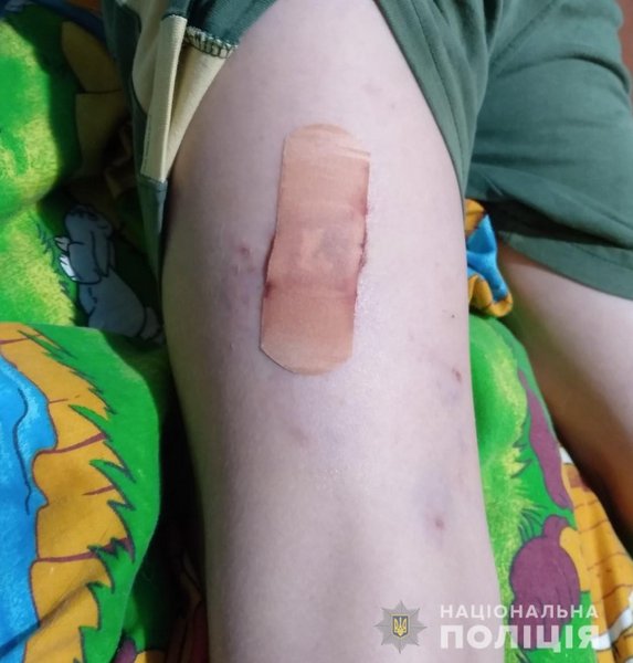 Собака, Каховка, мальчик