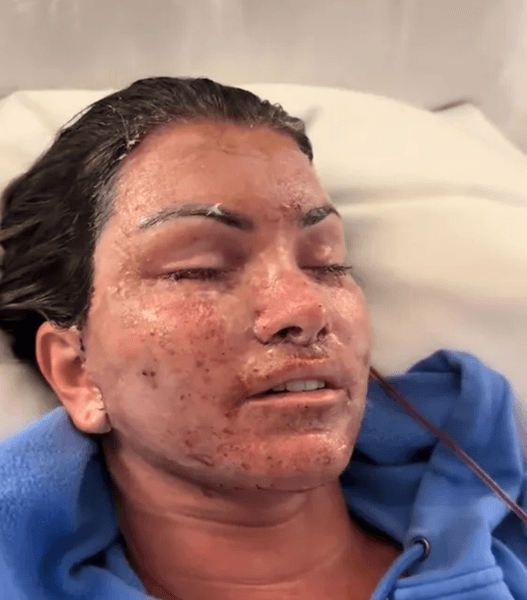 Эрика Вульф после операции