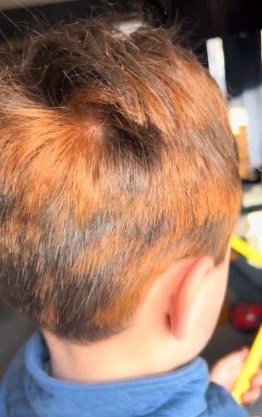 Колір волосся у дитини викликав суперечку в мережі, зовнішність, особливість, курйози