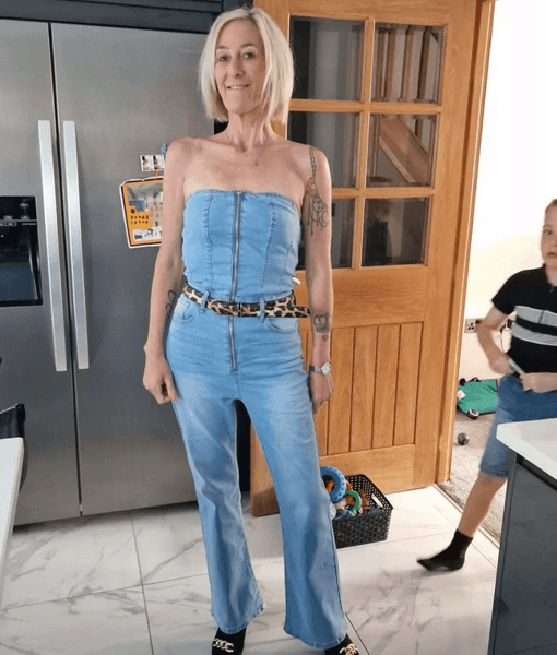 Женщина сбросила 51 кг, лишний вес, операция на похудение, диета, не могла похудеть, решилась на операцию, грубость врача