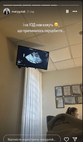 Марьяна Гутак о беременности