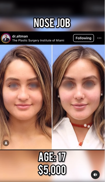 Известная блогерша Миа Дио призналась, что изменила себя благодаря пластическим операциям, хирургия, изменение внешности