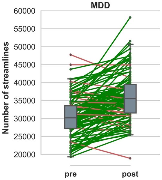 мозг, связи в мозге