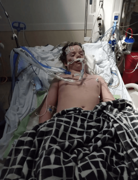 Подросток, мальчик, больница, вентиляция легких,