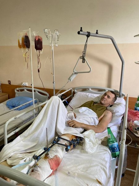 поранення Юрій Гудименко, Юрій Гудименко