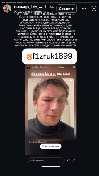 Жінка обзивала ветерана "маріупольським москалем" і розпилила балончик: що сталося (відео)