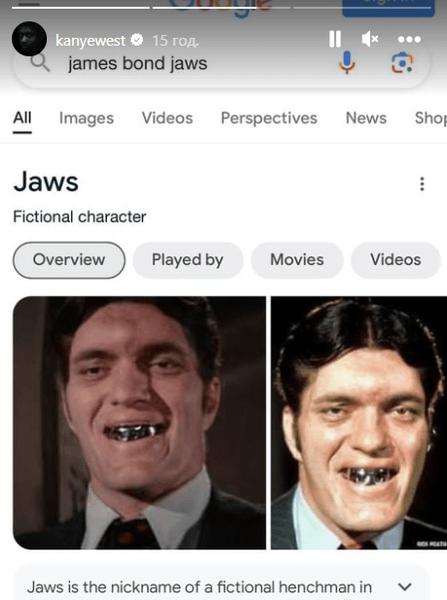 Канье Уэст, титановые зубы