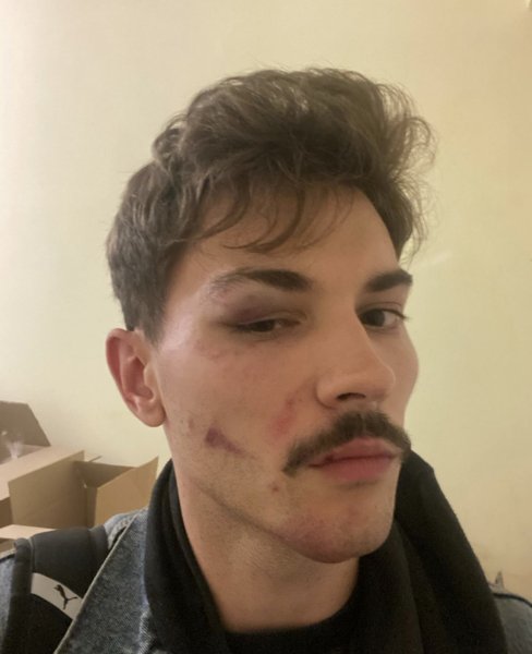 Владислав Каплієнко Владислав Каплієнко, побили ТЦК, мобілізація в Україні