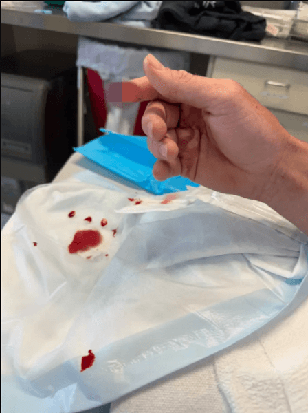 Жокей после доставки в больницу