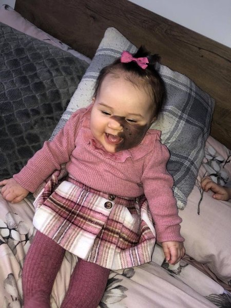 девочка, родинка, внешность