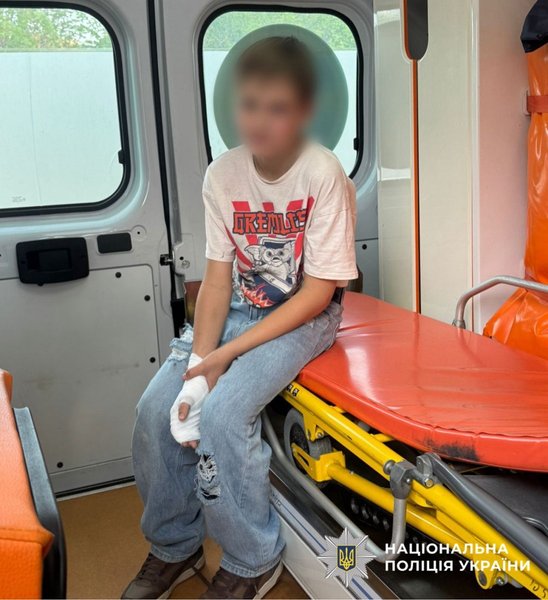 подросток шахед ожоги, взорвалась деталь шахеда