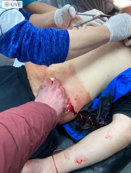 Львовская область, Сокаль, ножевые ранения в Сокале, отказ в оказании медпомощи