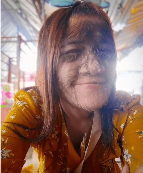 Самый волосатый подросток в мире, волосы на лице, Супатра Сасупхан, синдром оборотня, сменила образ, рекорд, Книга Гиннесса, синдром Амбраса