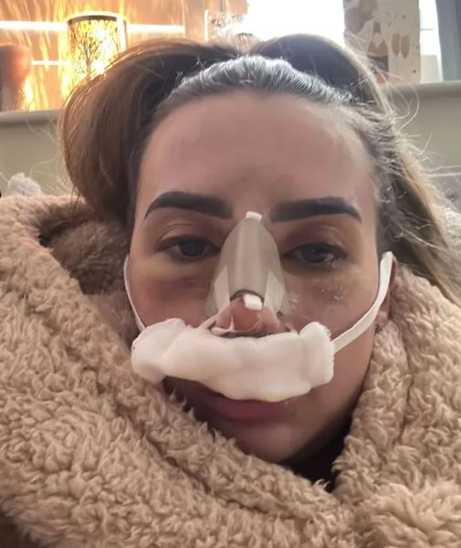 Ринопластика, операция по уменьшению носа, как исправить нос, опущенный кончик носа, внешность, красота