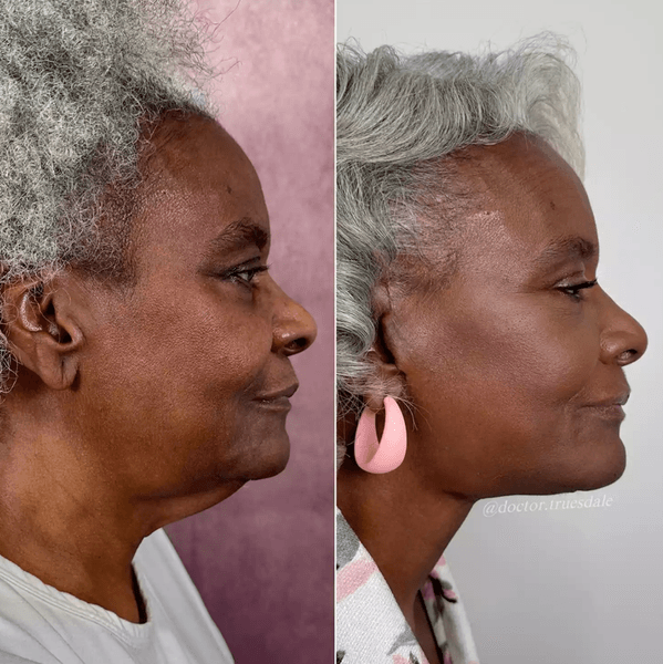 Пластическая операция, хирург, стоимость пластической операции, стоимость пластической операции