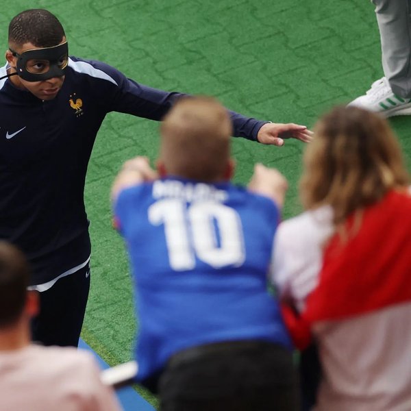 Мбаппе, пропустивший матч из-за перелома носа