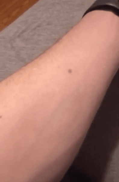 Веснушки на руках, родинки, курьезы, необычная теория, люди ищут веснушки на теле, научное объяснение, вирусный ролик