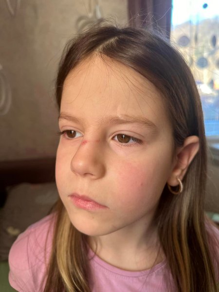 Пострадавшая девочка, ребенок