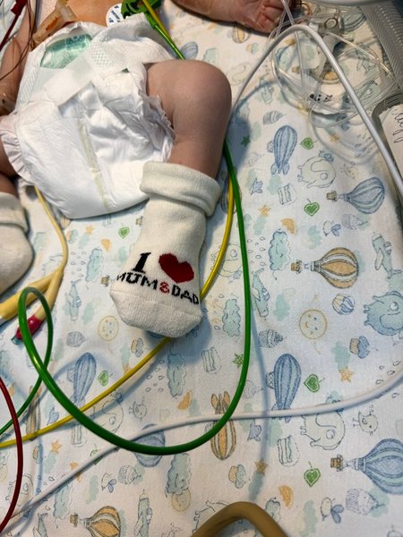 ребенок, первые минуты жизни, операция на сердце, порок сердца