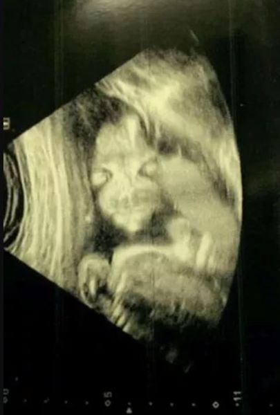 Беременная женщина испугалась, когда увидела своего ребенка на УЗИ, удивительные случаи из жизни