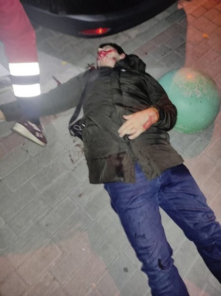 Олександра Іваніну застрелили в Сумах