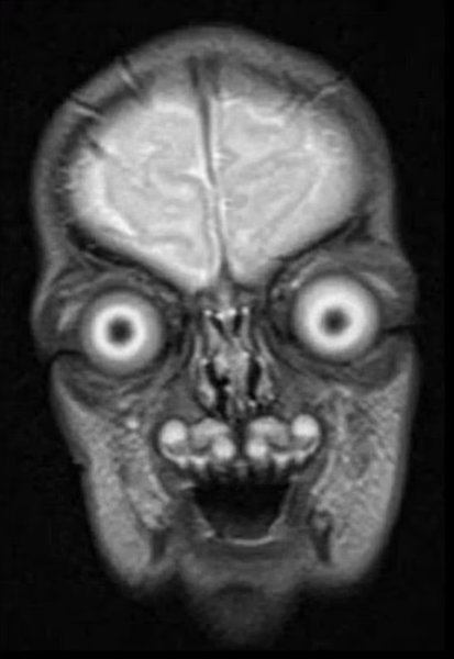 мрт скан дитина