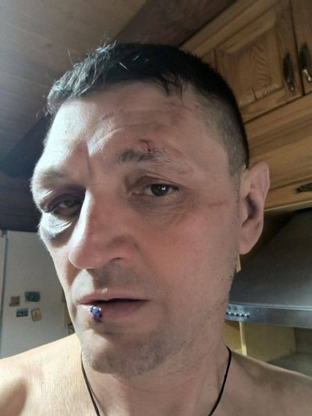 У ТЦК у Харкові побили чоловіка