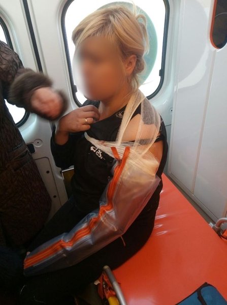 Женщину подстрелили в Марьинке, фото