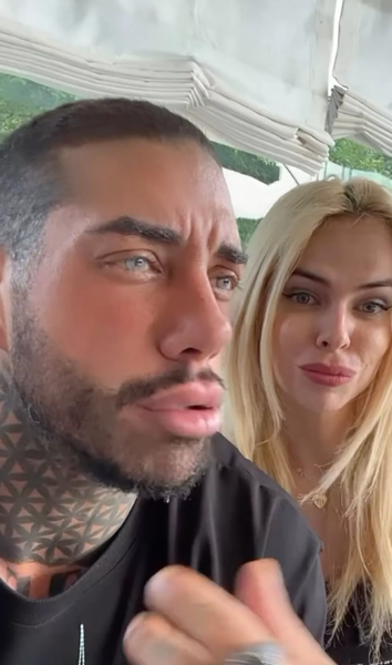 Звезда реалити-шоу Франческо Чиофало, изменение цвета глаз хирургическим способом, как увеличить рост, красота, внешность