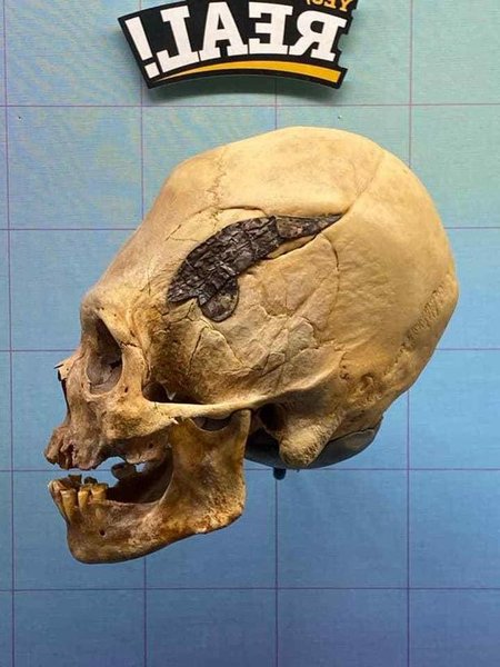 череп, мужчина, снимок