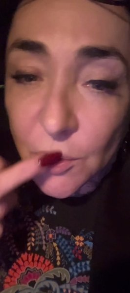 Лоліта Мілявська, співачка РФ, стан здоров'я, зуби