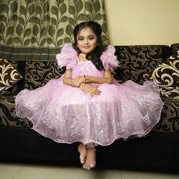 Дівчина з рідкісним захворюванням, дівчина, схожа на дитину, деформація кісток,