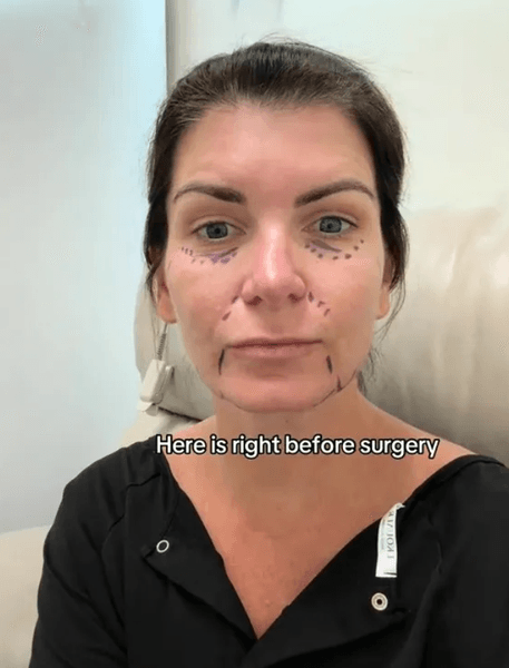 Эрика Вульф до операции