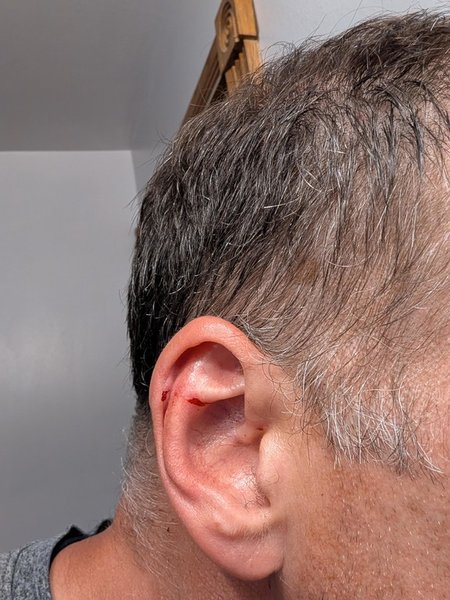 Травми чоловіка