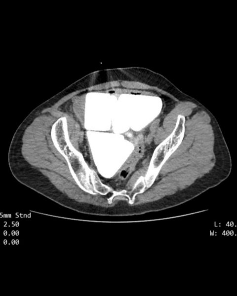 Обстеження показало дивні утворення
