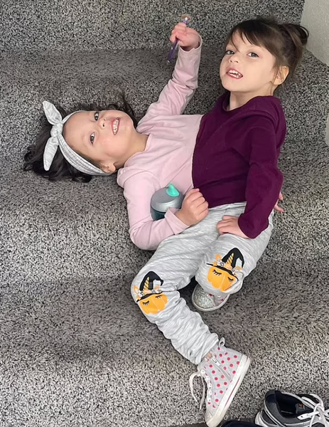 Біографія сіамських близнючок Келлі та Картер із США, унікальні діти, аномалії, операція, курйози, дивовижні історії, фото